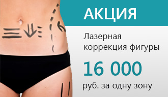 акция коррекция фигуры
