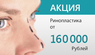 акция эстетическая ринопластика